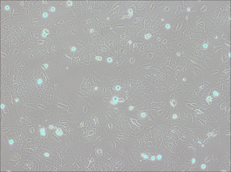 SCC-9 [SCC 9; SCC9] Cell Complete Medium - 2