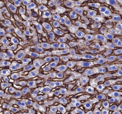Recombinant Scavenging Receptor SR-BI Monoclonal Antibody - small - 4