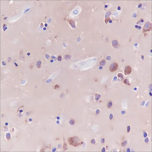 Recombinant GOT1 Monoclonal Antibody - small - 2