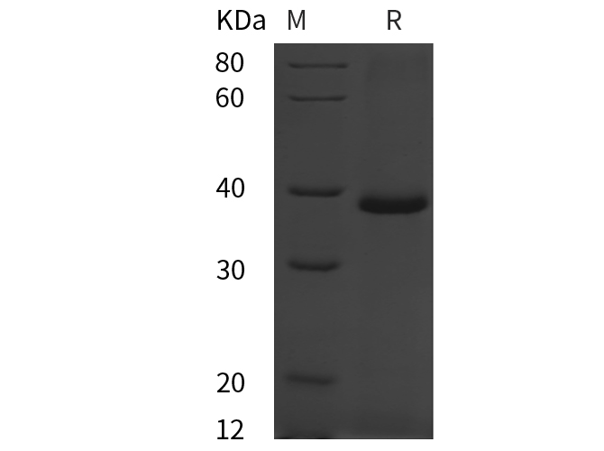 Recombinant Rat CD146/MCAM Protein(His Tag)-产品推荐-1