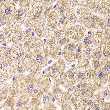Immunohistochemistry of paraffin-embedded Human liver damage using ST3GAL3 Polyclonal Antibody at dilution of 1:100 (40x lens).