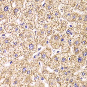 Immunohistochemistry of paraffin-embedded Human liver damage using ST3GAL3 Polyclonal Antibody at dilution of  1:100 (40x lens).