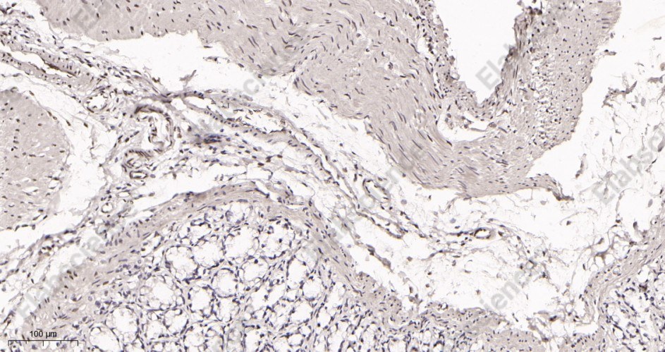 Recombinant AREB6 Monoclonal Antibody - 3