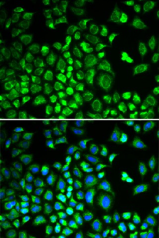 Immunofluorescence analysis of A549 cells using HAX1 Polyclonal Antibody Blue: DAPI for nuclear staining.