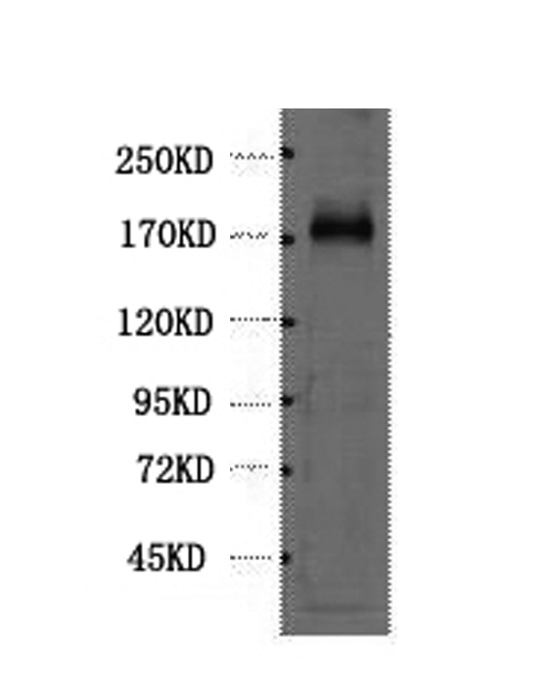 Western Blot analysis of Hela cells using EGFR Monoclonal Antibody at dilution of 1:1000.