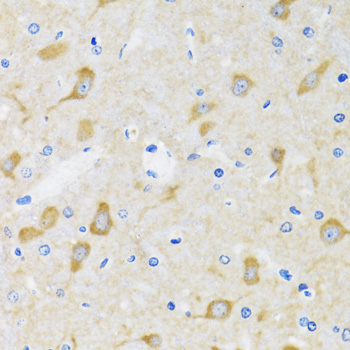 Immunohistochemistry of paraffin-embedded Mouse brain using HSPH1 Polyclonal Antibody at dilution of 1:100 (40x lens).