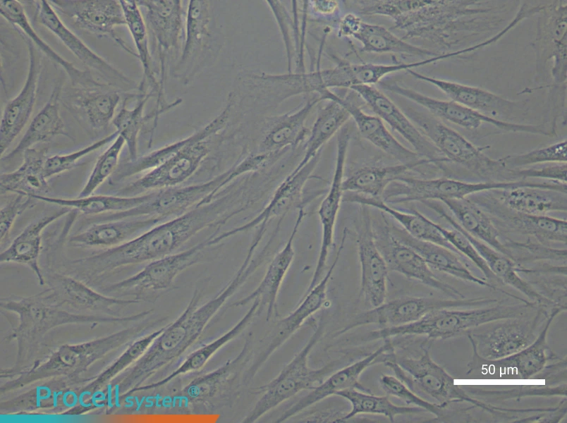 Human Synovial Fibroblast Complete Medium - 4