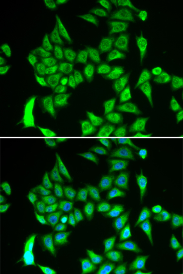 Immunofluorescence analysis of A549 cells using IREB2 Polyclonal Antibody