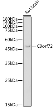 Western blot analysis of extracts of Rat brain using C9orf72 Polyclonal Antibody at 1:1000 dilution.