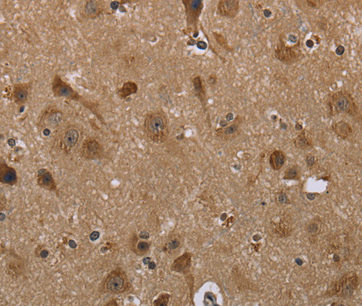 Immunohistochemistry of paraffin-embedded Human brain  tissue using LLGL1 Polyclonal Antibody at dilution 1:40