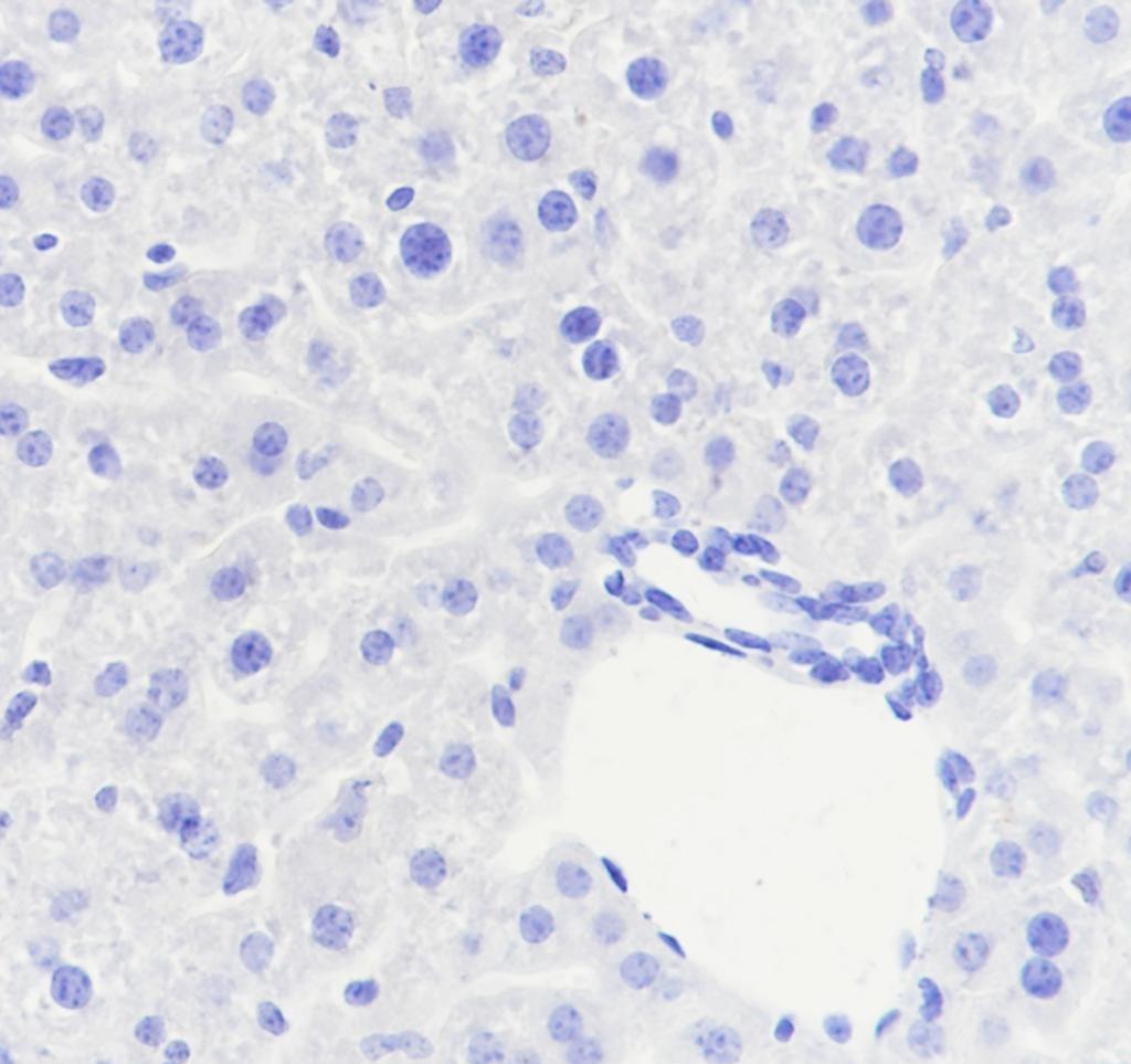 Recombinant CD8 beta Monoclonal Antibody - 3