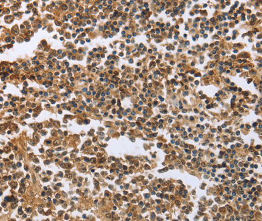 Immunohistochemistry of paraffin-embedded Human tonsil tissue using ECE1 Polyclonal Antibody at dilution 1:60