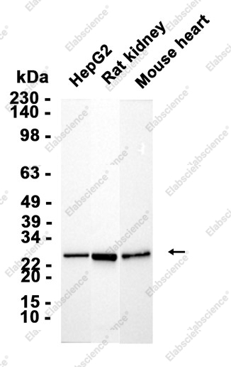 Recombinant AK2/Adenylate kinase 2 Monoclonal Antibody - 2