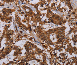 MOB1A Polyclonal Antibody - 2