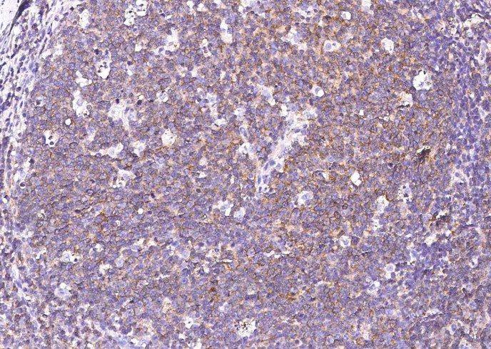 Recombinant CD150/SLAM/SLAMF1 Monoclonal Antibody-searchlist-1