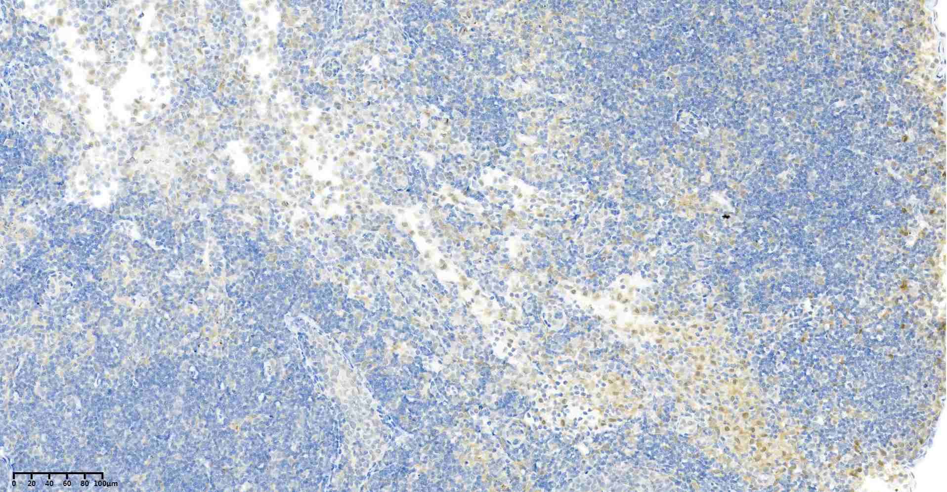 Recombinant p38 Monoclonal Antibody - 3
