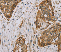 MVK Polyclonal Antibody - 3