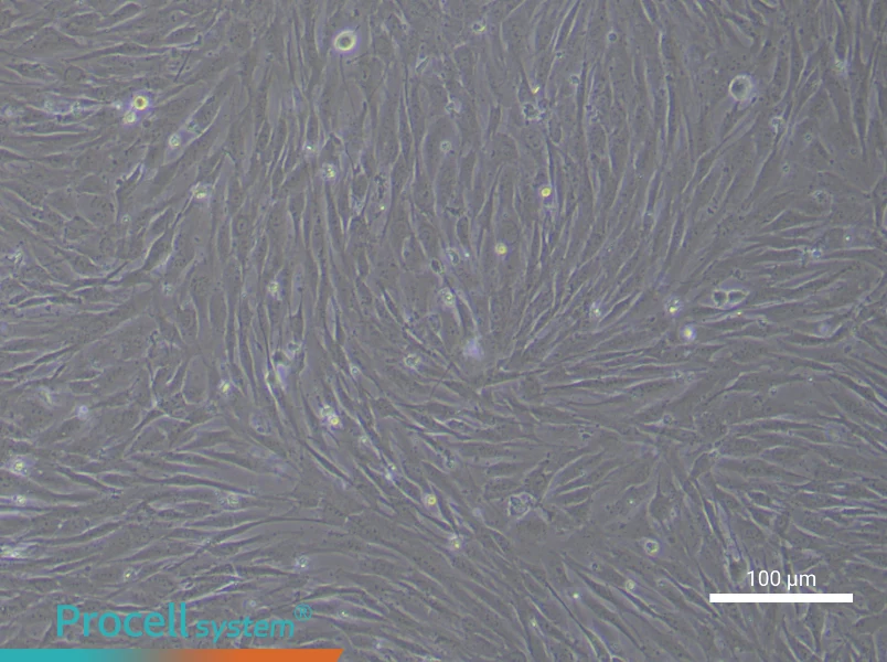 Human Aortic Smooth Muscle (Primary cell immortalization) Cell Complete Medium - 1