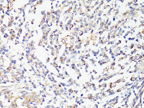 Immunohistochemistry of paraffin-embedded Human tonsil using mTOR Polyclonal Antibody at dilution of 1:150 (40x lens).
