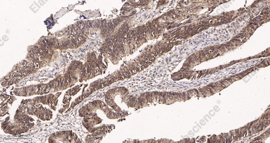 Recombinant Cyclin E1 Monoclonal Antibody - 2