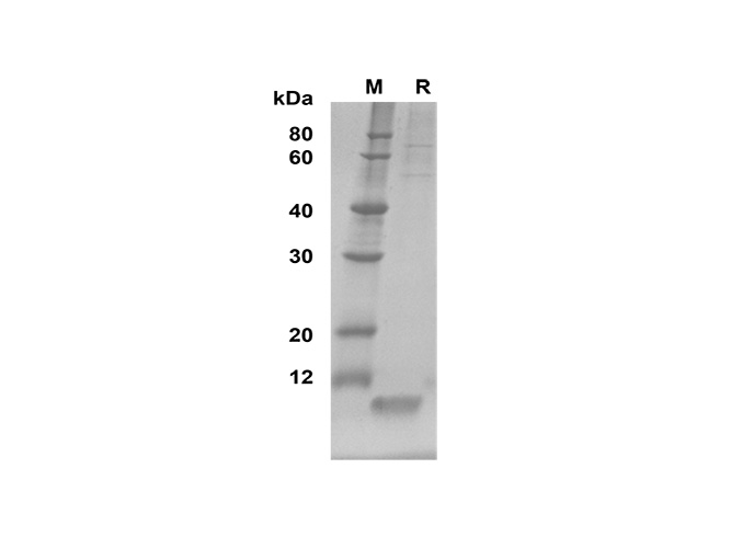 Recombinant Rat IL-17A Protein(hIgG1 Fc Tag)-产品推荐-1