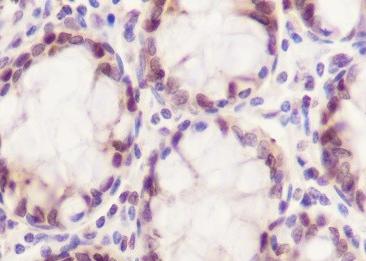 Recombinant HMGB2 Monoclonal Antibody-searchlist-2