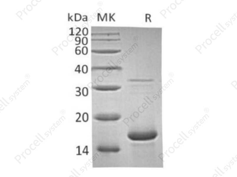 FGF-1/FGFa/FGF-acidic (Ala2-Asp155), Human, Recombinant