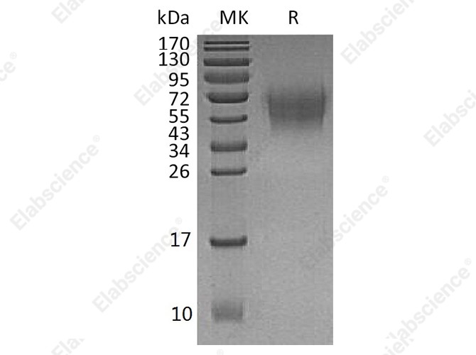 Recombinant Human CD226/DNAM-1 Protein (His Tag) - 1