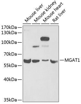 Western blot analysis of extracts of various cell lines using MGAT1 Polyclonal Antibody at 1:1000 dilution.