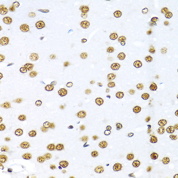 Immunohistochemistry of paraffin-embedded Rat brain using KHDRBS1 Polyclonal Antibody at dilution of  1:100 (40x lens).