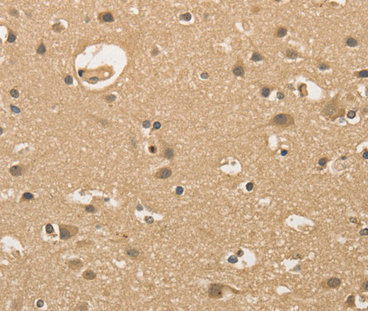 Immunohistochemistry of paraffin-embedded Human brain  using ALDH8A1 Polyclonal Antibody at dilution of 1:30