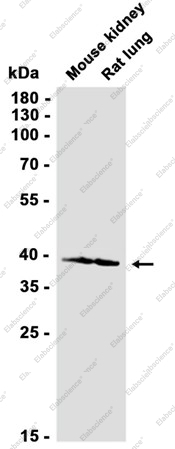 Recombinant CAB39 Monoclonal Antibody - 2