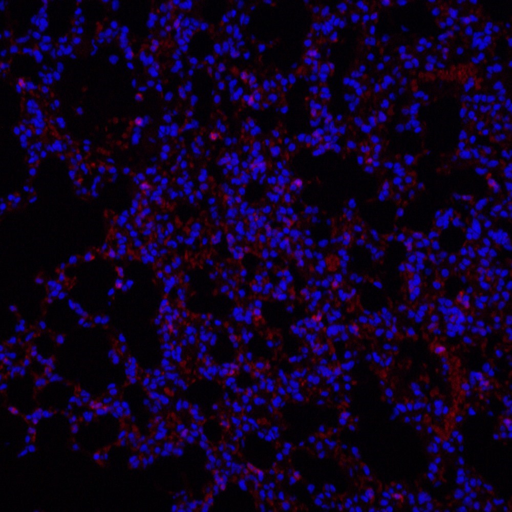 Immunofluorescence analysis of paraffin-embedded mouse Inflammatory lung using Ly6g Polyclonal Antibody at dilution of 1:200.