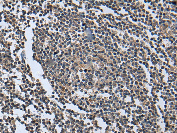 Immunohistochemistry of paraffin-embedded Human tonsil tissue  using WNT9B Polyclonal Antibody at dilution of 1:85(?200)