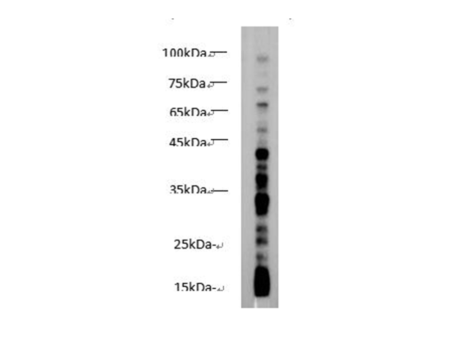 Western blot of anti-Butyry Lysine polyclonal antibody on Hela lysate at dilution of 1:1000.