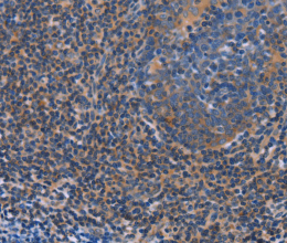 AGFG1 Polyclonal Antibody - 2