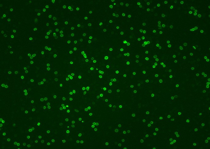 Recombinant CD4 Monoclonal Antibody - small - 2
