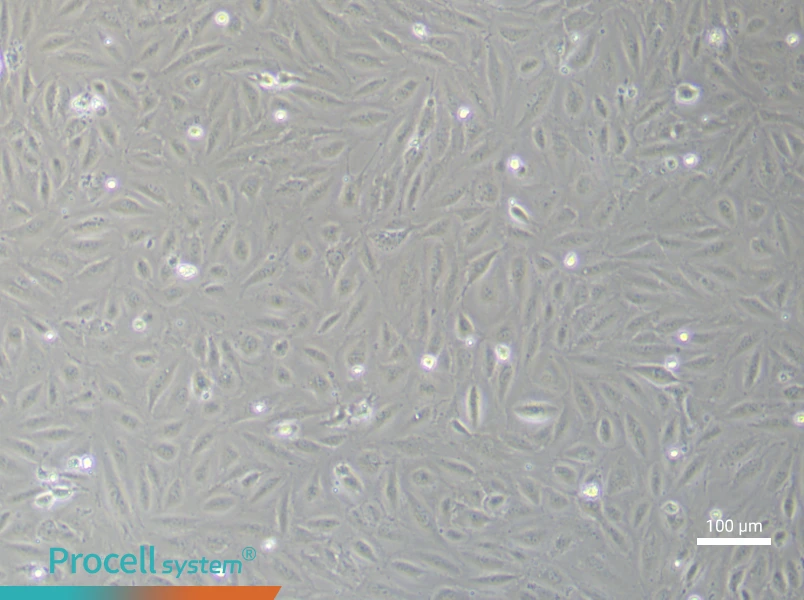 Human Endometrial Epithelial (Primary cell immortalization) Cell Complete MediumHuman Endometrial Epithelial (Primary cell immortalization) Cell Complete Medium - 1