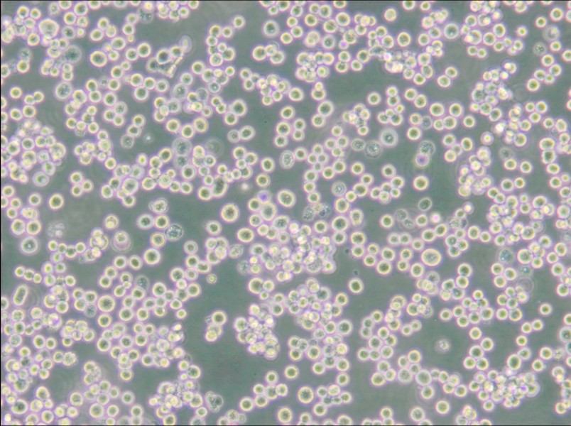 LLC-WRC 256 [Walker 256] Cell Complete Medium - 6