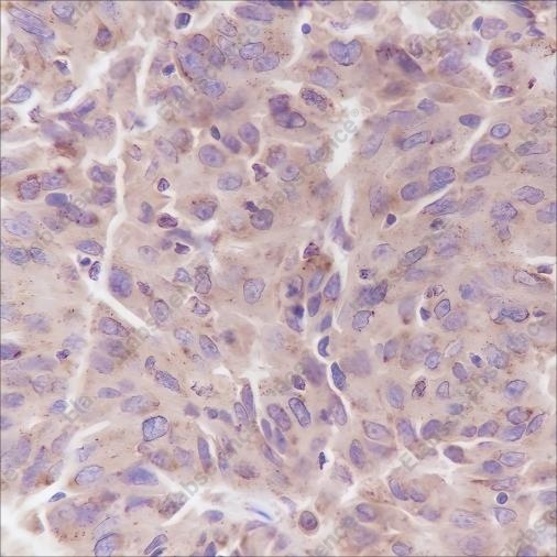 Recombinant PI3 Kinase p85 alpha Monoclonal Antibody - 1