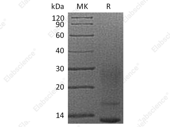 Recombinant Human Interleukin-13/IL-13 Protein (His Tag) - 1