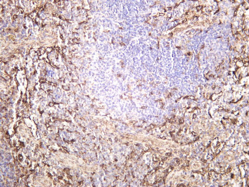 Recombinant ZO1 Monoclonal Antibody - small - 4