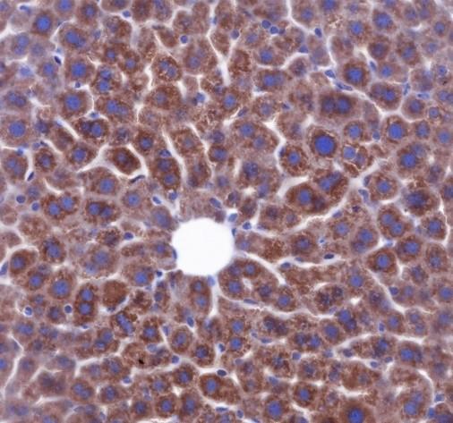 Recombinant SOD2 (Acetyl Lys68) Monoclonal Antibody - small - 3