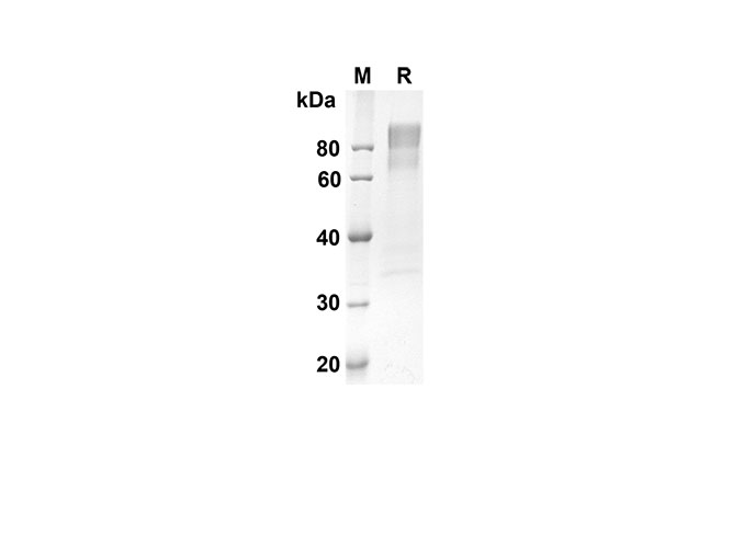 Recombinant Human CD30 Protein(Fc Tag)-1