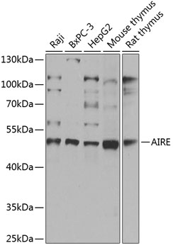 Western blot analysis of extracts of various cell lines using AIRE Polyclonal Antibody at 1:1000 dilution.