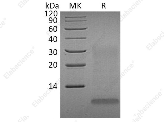 Recombinant Human INSL4 Protein (His Tag) - 1