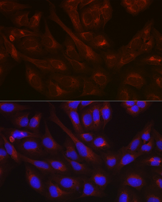 Immunofluorescence analysis of U-2 OS cells using NSF Polyclonal antibody at dilution of 1:100 (40x lens). Blue: DAPI for nuclear staining.