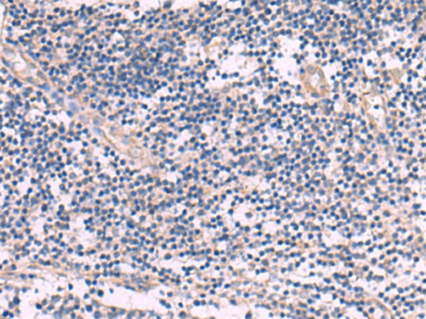 Immunohistochemistry of paraffin-embedded Human tonsil tissue  using NIPSNAP1 Polyclonal Antibody at dilution of 1:35(?200)