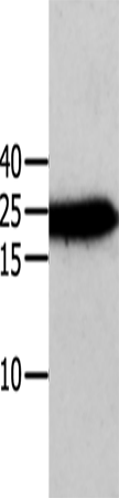 Western Blot analysis of Human cervical cancer tissue using ANXA5 Polyclonal Antibody at dilution of 1:750