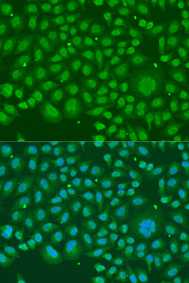 Immunofluorescence analysis of U2OS cells using HNRNPR Polyclonal Antibody at dilution of 1:100. Blue: DAPI for nuclear staining.